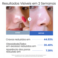 Tonico Facial em Pads Medicube Toner Pads Zero Pore – Tônico Facial em Pads (70 Unidades) 155g, foto 3